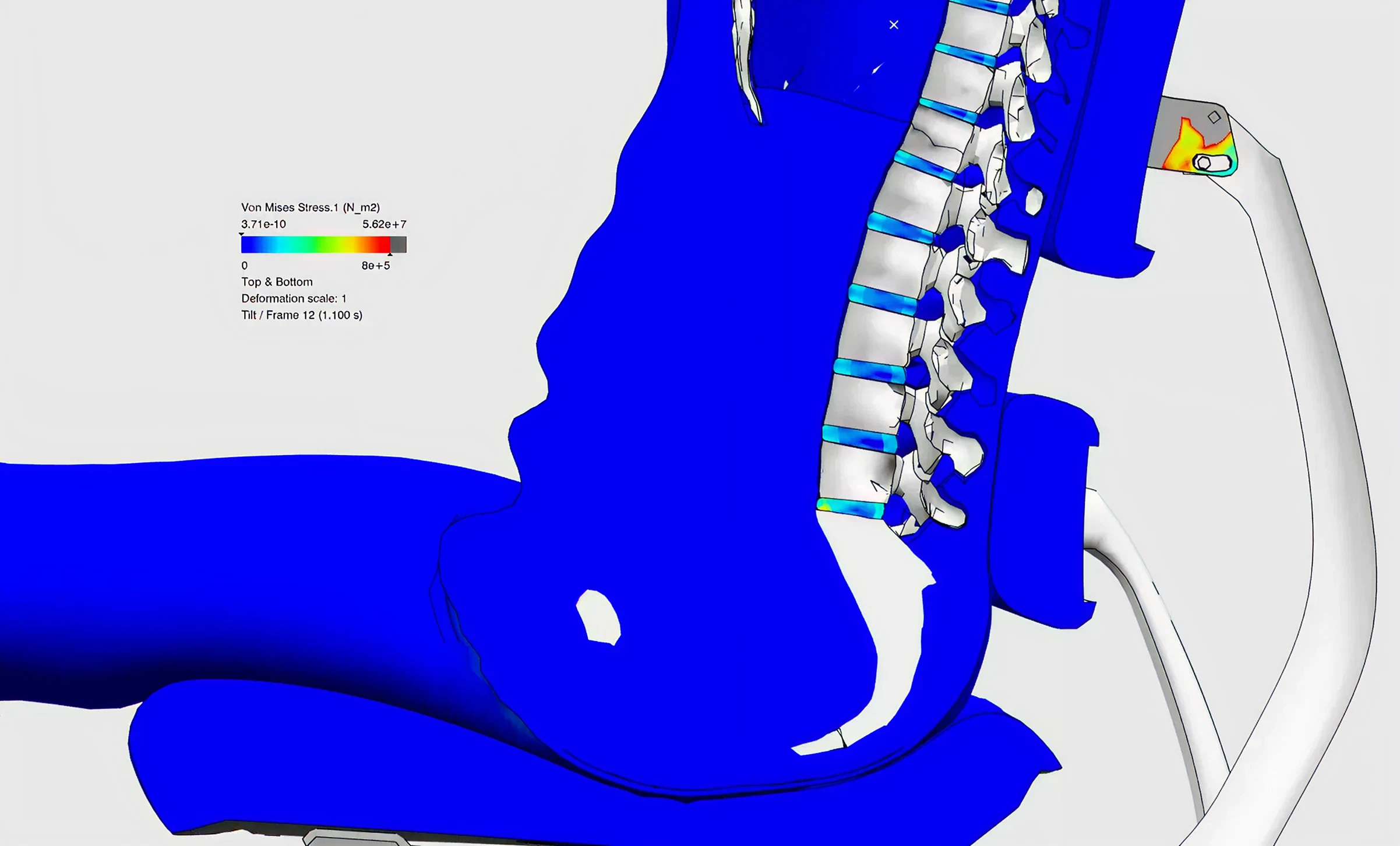 814005c65cbe6f78b1389a65b25c6ec18bf477fa