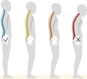 4-pictures-of-diff-posture
