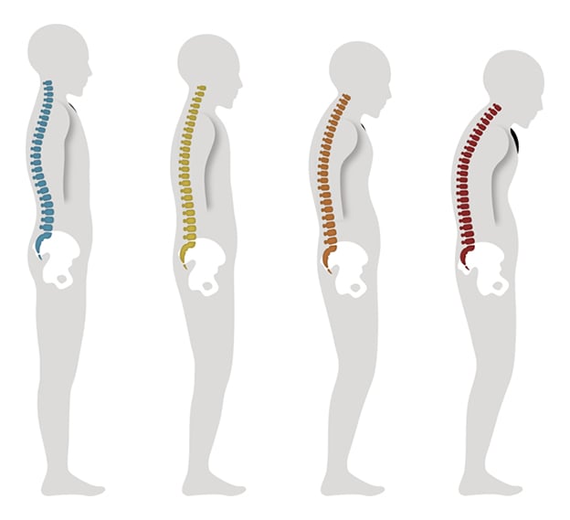 Can your posture impact how long you live? The evidence says yes!