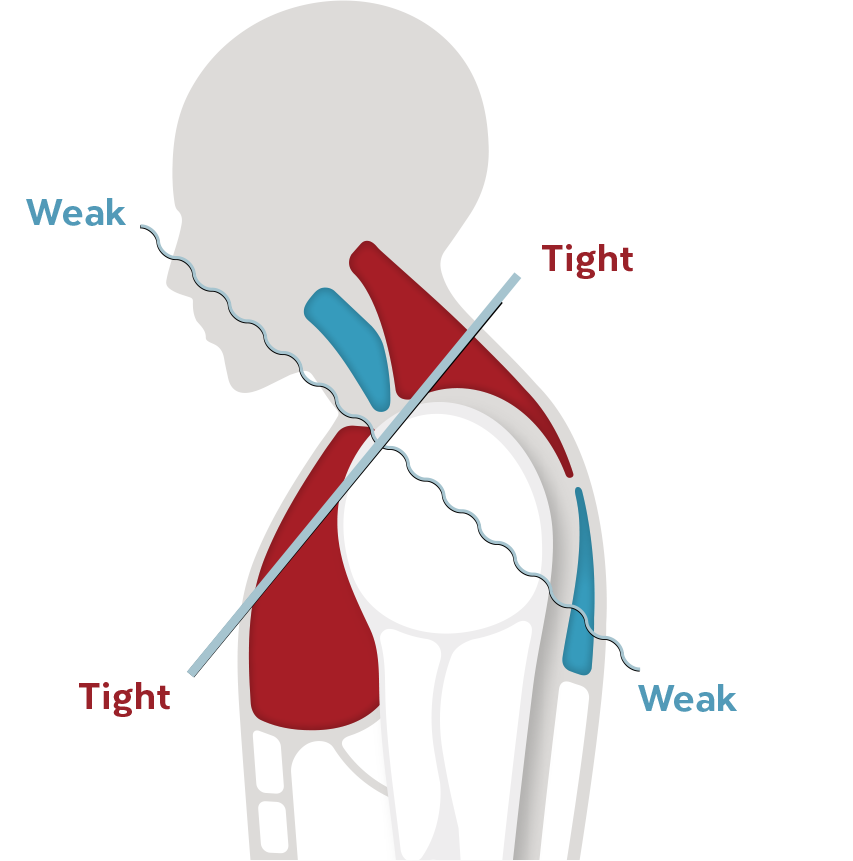 img_neck_sholuder-pain