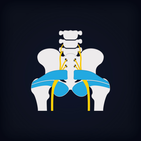 piriformis-syndrome-img