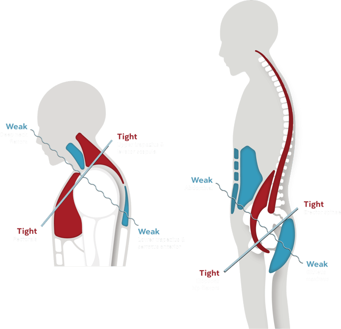 posture-img