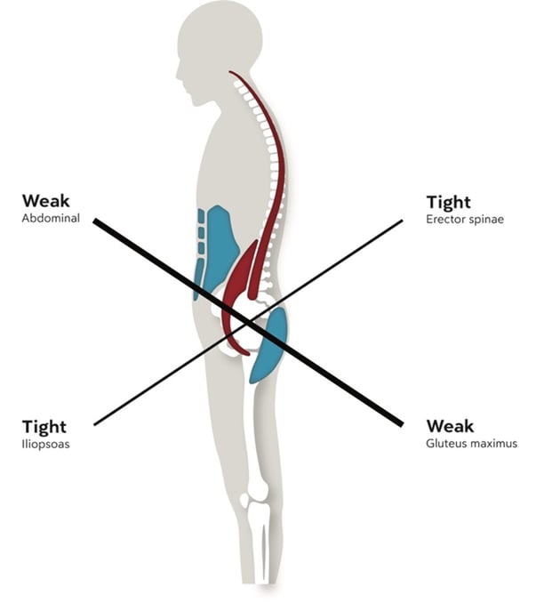 Sciatica Relief Explained The Power of Massage Explored!