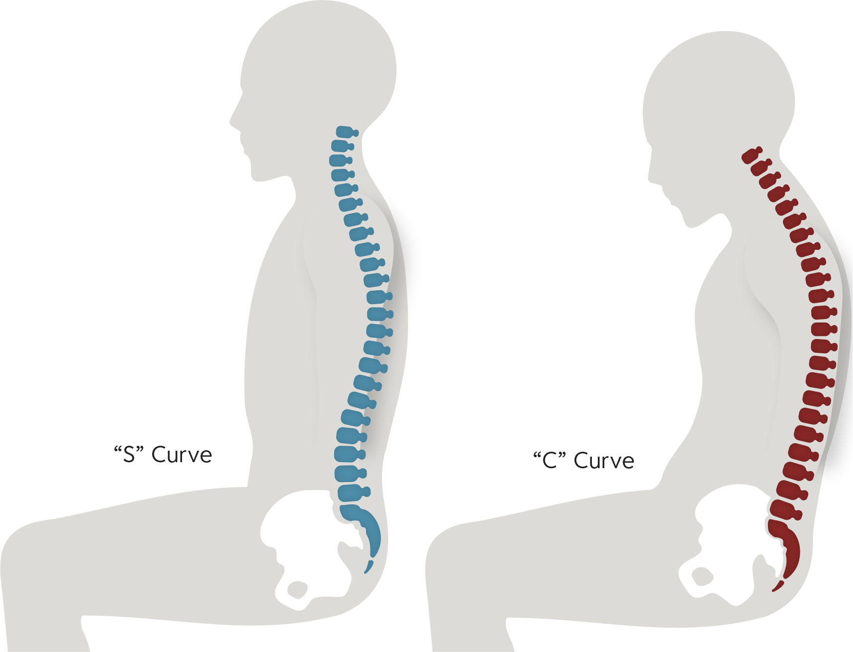 curved-spine-in-seated-position