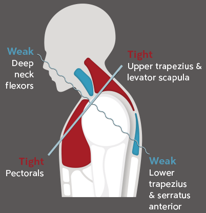 prt6