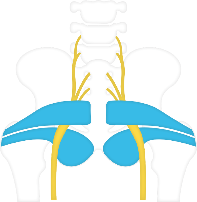 Piriformis Seat Cushion for Sciatica Hip Bursitis Tailbone Sacroiliac Chair